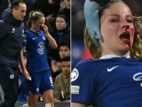 Chelsea star Leupolz pokes fun at herself after she was left with blood streaming down her face