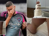 Tony Bellew admits ‘pain is real’ after surgery on gruesome Achilles injury suffered in Soccer Aid game – after saying it felt like he ‘had been shot’