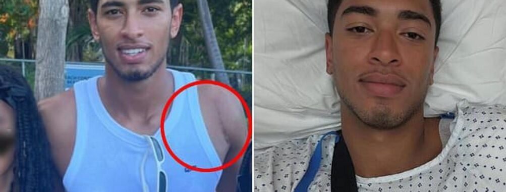 Jude Bellingham reveals nasty-looking shoulder scar after England star went under the knife following TWO-YEAR ordeal with secret issue